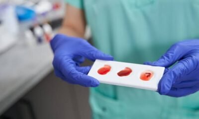 ABS Testauslösung: Find Why It Matters